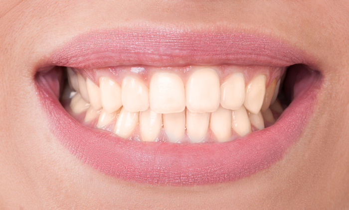 dental patient with yellow teeth