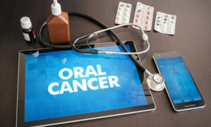 oral cancer exam