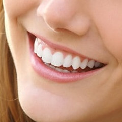 veneers